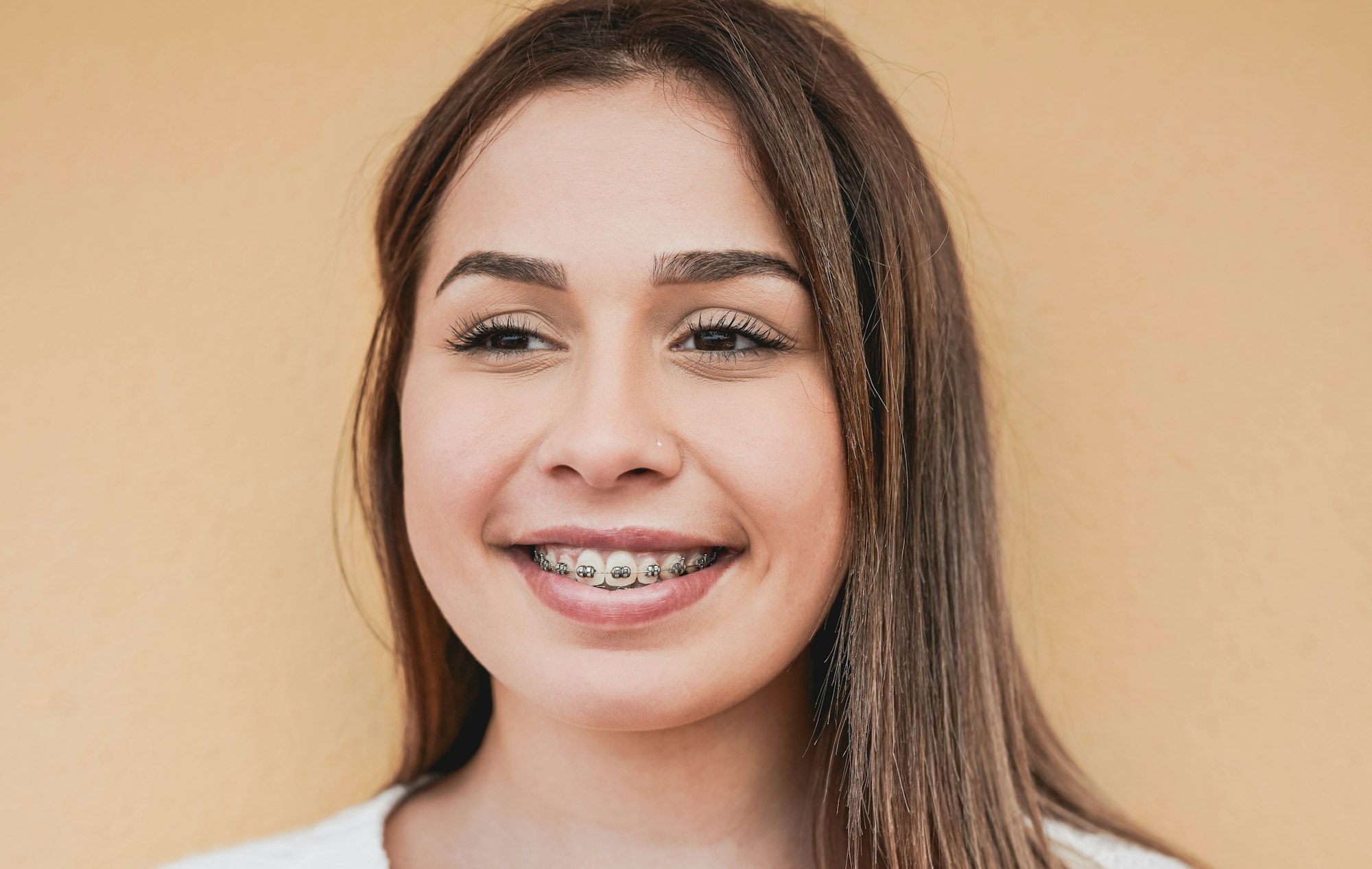 Beautiful teenage girl with dental braces smiling in front of camera