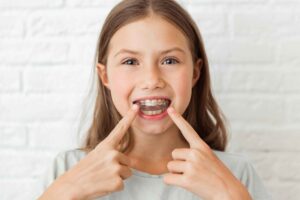 Clear Aligners For Teens