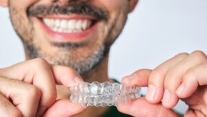 Clear Aligners