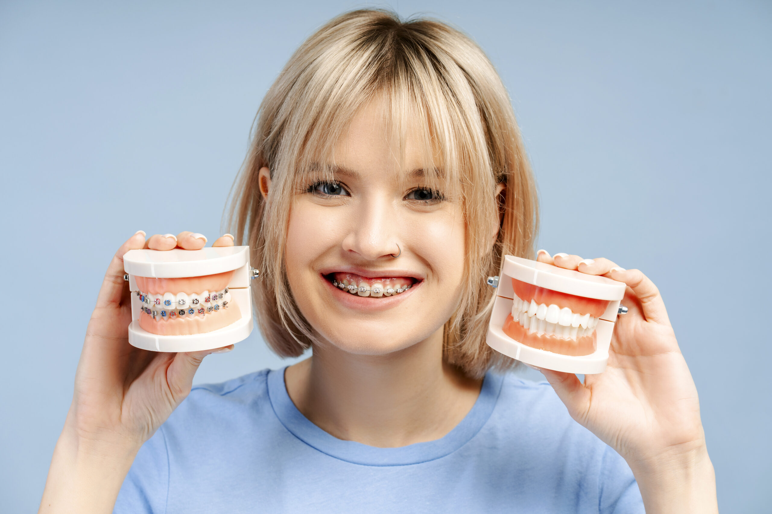 customized-orthodontic-appliances