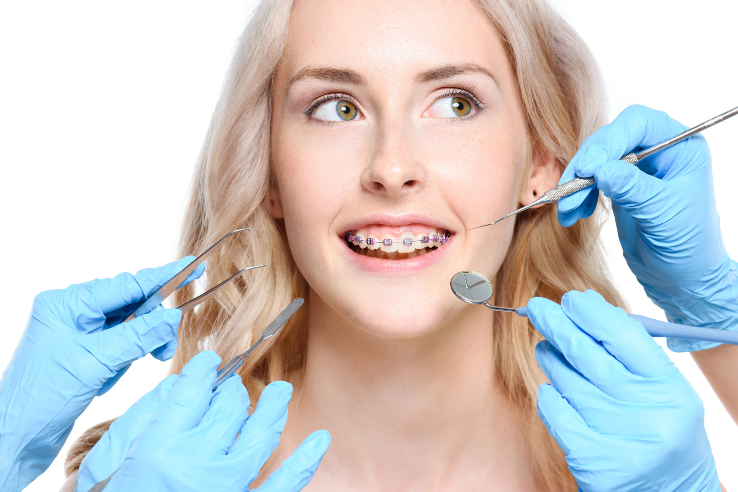 ceramic-braces-treatment