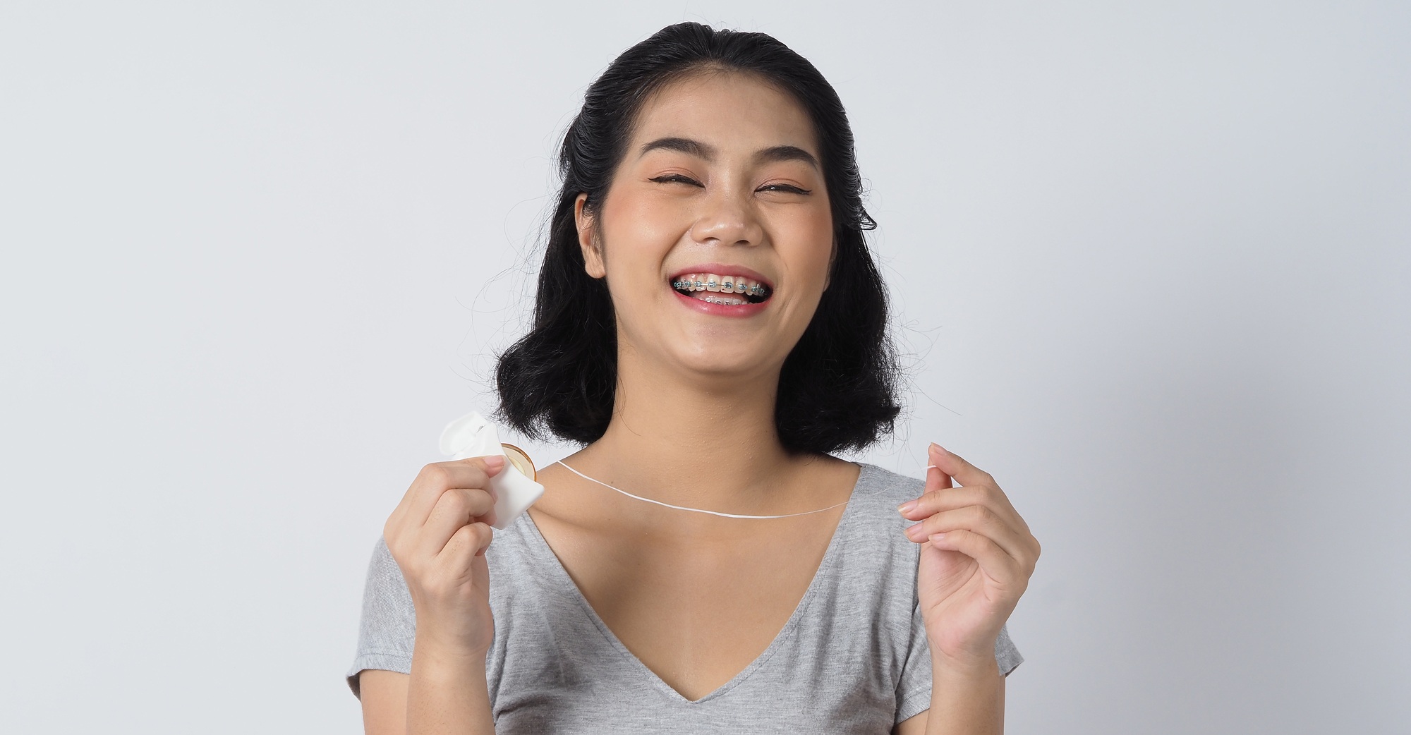 Dental brace teen girl smiling looking on a camera. white teeth with blue braces. Dental care. Asian