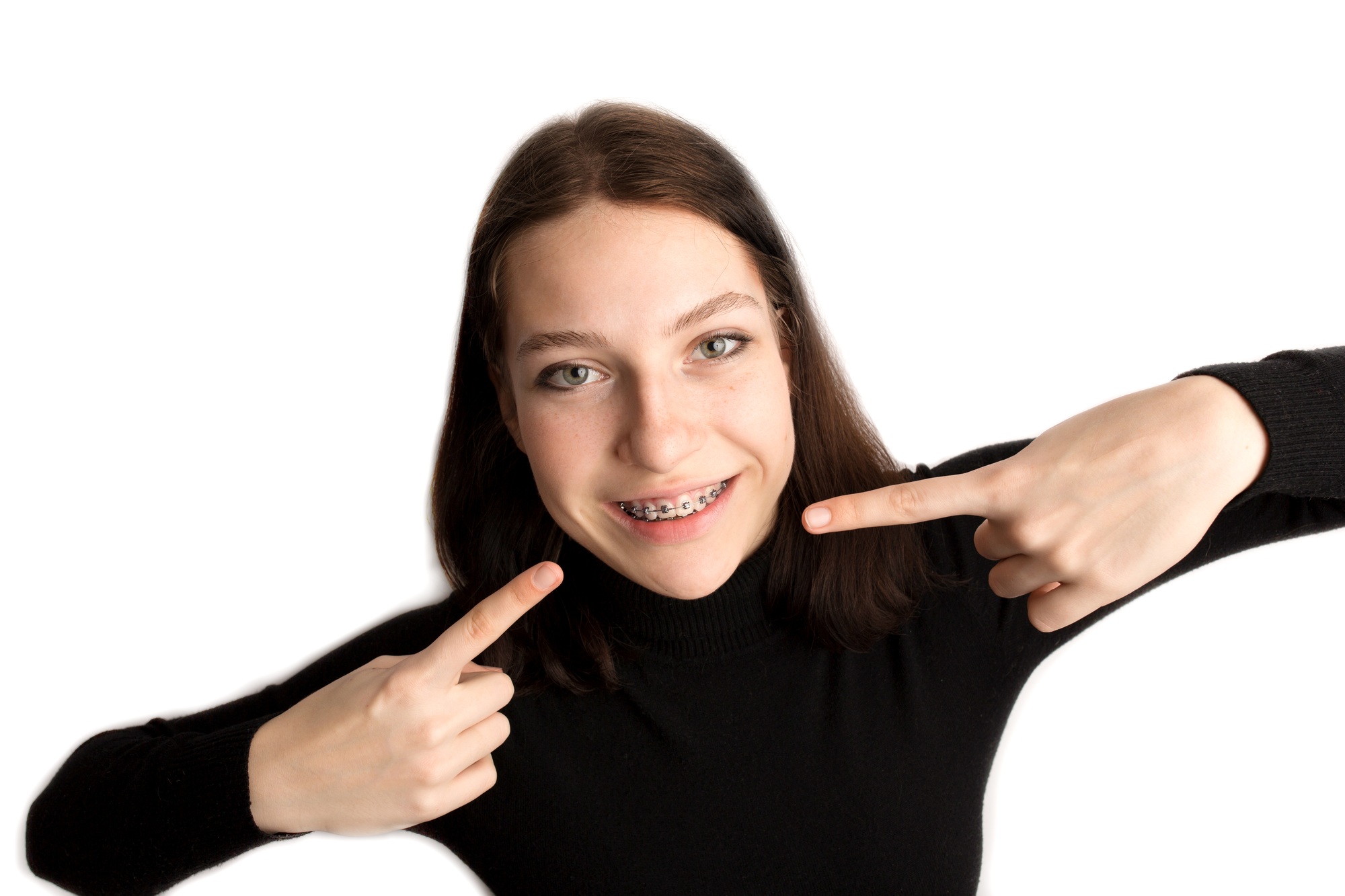 Orthodontic treatment. Dental care concept. Smiling teenage girl with braces.
