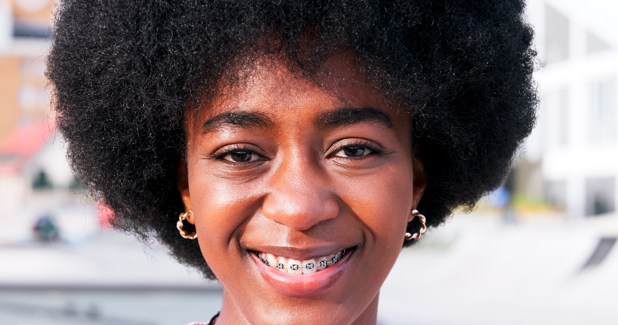 Outdoor, black woman and happy on portrait with braces for dental hygiene and oral care in Kenya. M