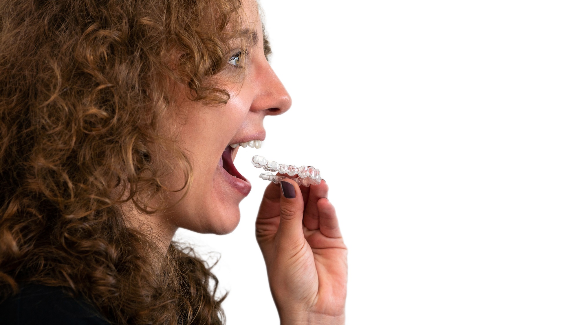 Woman put transparent braces dental correction. Invisible orthodontic retainer