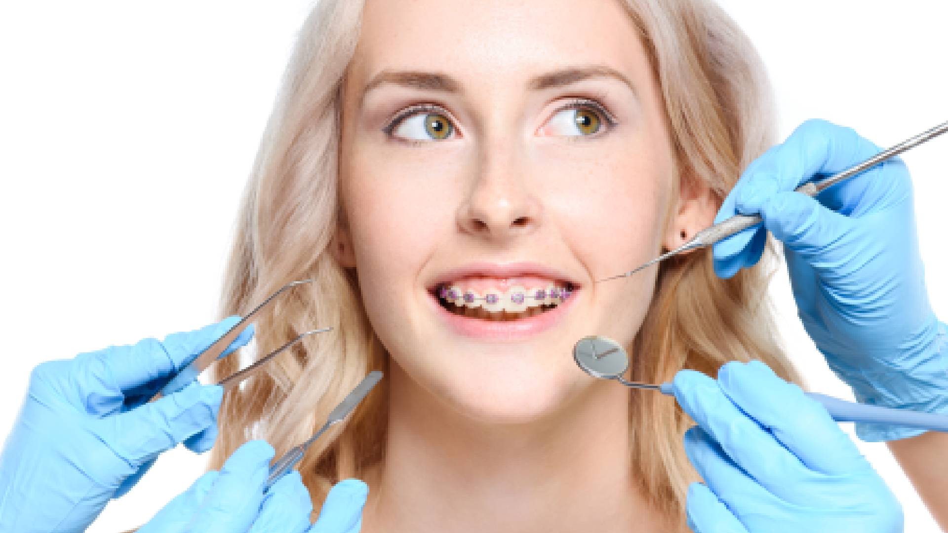 Braces Tightening Appointment: Common Questions Answered