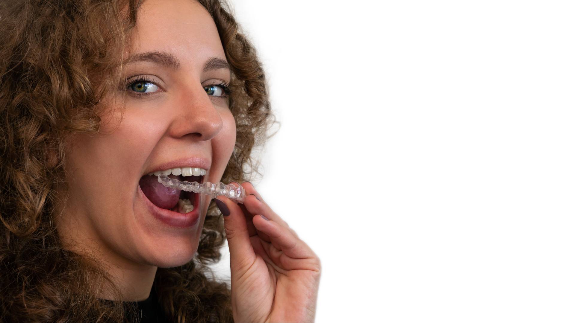 Self Ligating Braces: The Efficient Way to Straighten Teeth