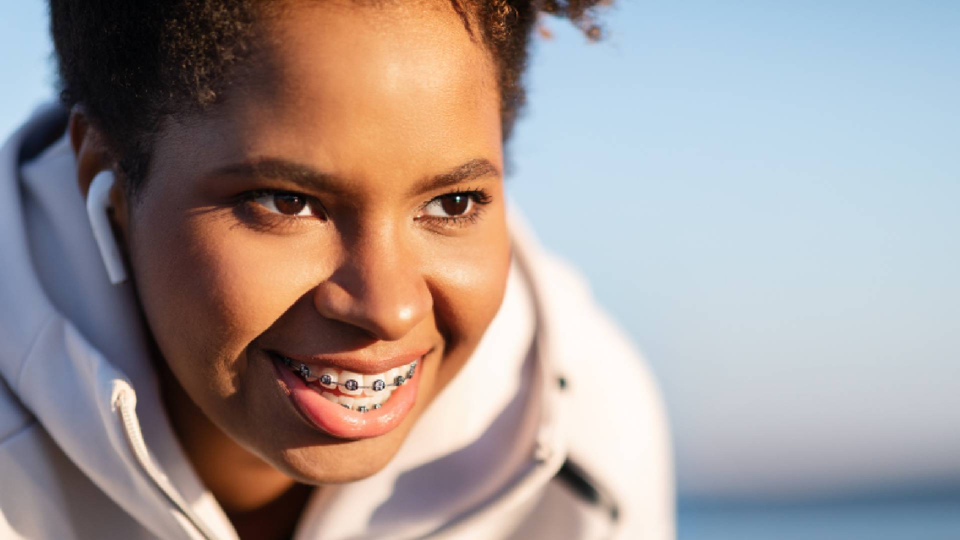 The Ultimate Comparison of Clear Braces Options Available